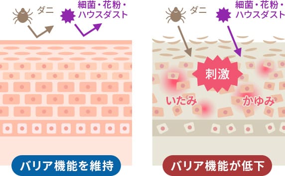 皮膚の正常なバリア機能とバリア機能が低下した場合の図